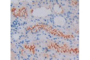 Used in DAB staining on fromalin fixed paraffin- embedded kidney tissue