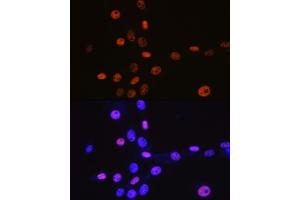 Immunofluorescence analysis of NIH-3T3 cells using MCM3 Rabbit mAb (ABIN7268540) at dilution of 1:100 (40x lens).