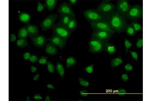 Immunofluorescence of monoclonal antibody to SNAI2 on HeLa cell. (SLUG anticorps  (AA 97-169))