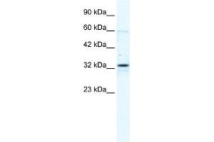 WB Suggested Anti-GJB1 Antibody Titration:  2. (GJB1 anticorps  (C-Term))