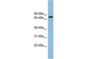 Image no. 1 for anti-Lamin B Receptor (LBR) (AA 503-552) antibody (ABIN6749731) (Lamin B Receptor anticorps  (AA 503-552))