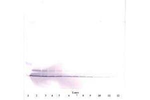 Image no. 3 for anti-Platelet Factor 4 (PF4) antibody (ABIN465152) (PF4 anticorps)