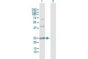 Lane 1: ARL4D transfected lysate ( 22. (ARL4D 293T Cell Transient Overexpression Lysate(Denatured))