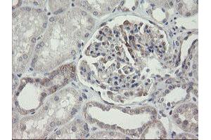 Image no. 7 for anti-ADP-Ribosylation Factor-Like 2 Binding Protein (ARL2BP) antibody (ABIN1496715)