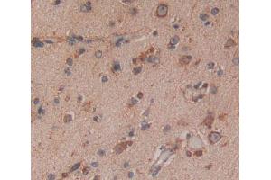 IHC-P analysis of Kidney tissue, with DAB staining. (IRF8 anticorps  (AA 128-426))
