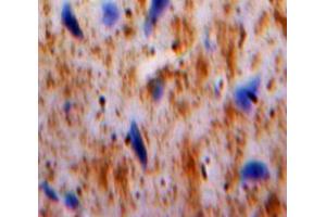 IHC-P analysis of Brain tissue, with DAB staining. (PLAUR anticorps  (AA 123-216))