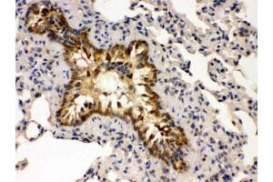 IHC testing of FFPE mouse lung with GRK5 antibody. (GRK5 anticorps)