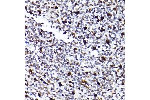 Immunohistochemistry of paraffin-embedded human tonsil using MCM2 Rabbit mAb (ABIN7268538) at dilution of 1:100 (40x lens).