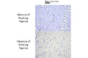 Immunohistochemistry analysis of a competition assay demonstrating the specificity of the anti-Tau (Ser 208/210) antibody (tau anticorps  (pSer208, pSer210))
