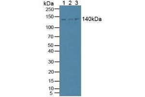 Figure. (Phospholipase C beta 1 anticorps  (AA 316-476))