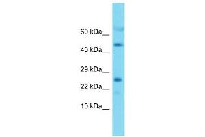 Western Blotting (WB) image for anti-Mitochondrial Ribosomal Protein L22 (MRPL22) (Middle Region) antibody (ABIN2789277)