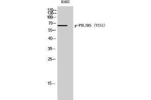 Western Blotting (WB) image for anti-PDZ and LIM Domain 5 (PDLIM5) (pTyr251) antibody (ABIN3182122) (PDLIM5 anticorps  (pTyr251))
