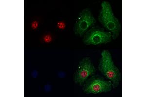 ABIN7093962 and ABIN7098006 staining Hela cells by IF/ICC.
