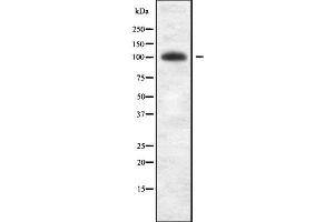 Western blot analysis of OPA1 Antibody expression in A431 cells lysates. (OPA1 anticorps  (Internal Region))