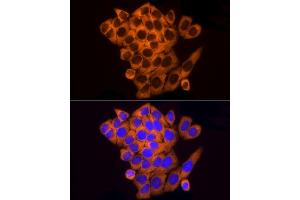 Immunofluorescence analysis of HeLa cells using RPL10A Rabbit mAb (ABIN7269992) at dilution of 1:100 (40x lens). (RPL10A anticorps)