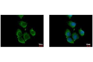 ICC/IF Image RhoC antibody detects RHOC protein at cytoplasm by immunofluorescent analysis.