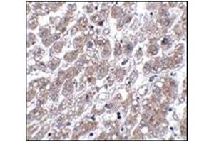 Immunohistochemistry of MATN1 in human liver tissue with this product at 5 μg/ml. (MATN1 anticorps  (C-Term))
