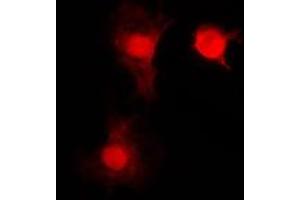 Immunofluorescent analysis of SNAI1 staining in HEK293T cells. (SNAIL anticorps  (C-Term))