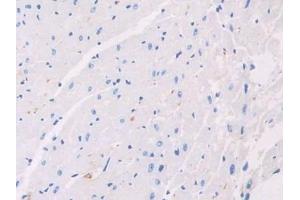 Detection of AHSG in Mouse Cardiac Muscle Tissue using Polyclonal Antibody to Alpha-2-Heremans Schmid Glycoprotein (AHSG)