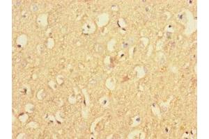 Immunohistochemistry of paraffin-embedded human brain tissue using ABIN7167338 at dilution of 1:100 (RAB4B anticorps  (AA 1-278))