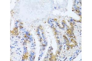Immunohistochemistry of paraffin-embedded Rat lung using NAT2 Polyclonal Antibody at dilution of 1:100 (40x lens). (NAT2 anticorps)