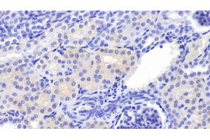 Detection of Cys-C in Porcine Kidney Tissue using Polyclonal Antibody to Cystatin C (Cys-C) (CST3 anticorps  (AA 42-127))