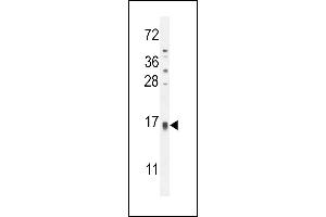 TCL6 Antibody (C-term) (ABIN654803 and ABIN2844478) western blot analysis in HL-60 cell line lysates (35 μg/lane).