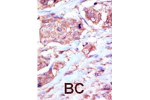Immunohistochemistry (IHC) image for anti-EPH Receptor B6 (EPHB6) antibody (ABIN3003353) (EPH Receptor B6 anticorps)