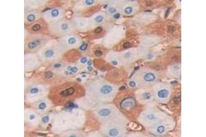 IHC-P analysis of Human Tissue, with DAB staining. (PIAS3 anticorps  (AA 11-280))