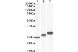 Western Blotting (WB) image for anti-Casein Kinase 2, beta (CSNK2B) antibody (ABIN5886333) (CSNK2B anticorps)