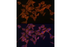 Immunofluorescence analysis of NIH-3T3 cells using Syntaxin 4 Rabbit mAb (ABIN7270687) at dilution of 1:100 (40x lens). (Syntaxin 4 anticorps)