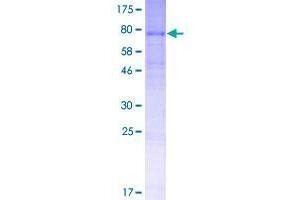 Image no. 1 for Solute Carrier Family 35, Member D3 (SLC35D3) (AA 1-416) protein (GST tag) (ABIN1320397)