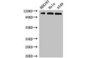 Western Blot Positive WB detected in: HEK293 whole cell lysate, Hela whole cell lysate, A549 whole cell lysate All lanes: IPO13 antibody at 3 μg/mL Secondary Goat polyclonal to rabbit IgG at 1/50000 dilution Predicted band size: 109 kDa Observed band size: 109 kDa (IPO13 anticorps  (AA 501-700))