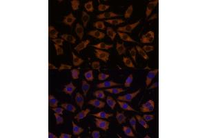 Immunofluorescence analysis of L929 cells using EIF5B antibody (ABIN7267052) at dilution of 1:100. (EIF5B anticorps  (AA 1-273))