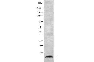 Western blot analysis NDUFA1 using K562 whole cell lysates (NDUFA1 anticorps  (Internal Region))
