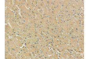 ABIN6262960 and ABIN6273263 at 1/100 staining human normal liver tissue by IHC-P. (EIF2D anticorps  (Internal Region))