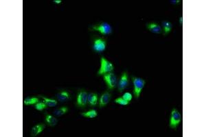 Immunofluorescence staining of Hela cells with ABIN7153319 at 1:66, counter-stained with DAPI. (G Protein-Coupled Receptor 12 anticorps  (AA 1-48))
