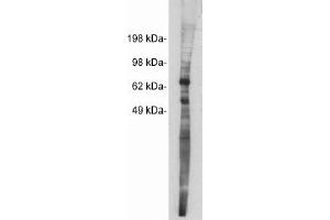 Image no. 1 for anti-Netrin 1 (NTN1) antibody (ABIN265184) (Netrin 1 anticorps)
