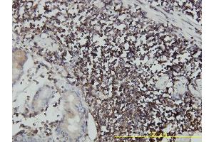 anti-Intercellular Adhesion Molecule 3 (ICAM3) (AA 30-547) antibody