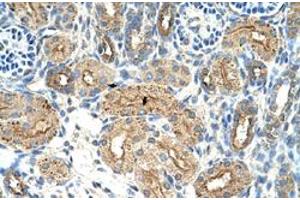 Immunohistochemical staining (Formalin-fixed paraffin-embedded sections) of human kidney with CTDSPL polyclonal antibody  at 4-8 ug/mL working concentration. (CTDSPL anticorps  (N-Term))