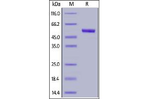 Human TSLP (R127A, R130A), Mouse IgG2a Fc Tag on  under reducing (R) condition.
