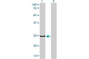 Western Blotting (WB) image for anti-Clathrin, Light Chain B (CLTB) (AA 1-212) antibody (ABIN598618) (CLTB anticorps  (AA 1-212))