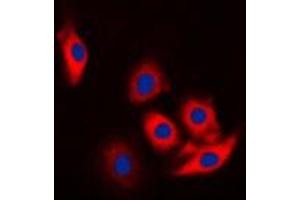 Immunofluorescent analysis of c-CBL (pY774) staining in Jurkat cells. (CBL anticorps  (C-Term, pTyr774))