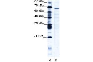 WB Suggested Anti-PSIP1 AntibodyTitration: 5 µg/mL  Positive Control: Jurkat Whole Cell  PSIP1 is strongly supported by BioGPS gene expression data to be expressed in Human Jurkat cells