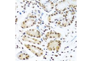 Immunohistochemistry of paraffin-embedded human stomach using CIRBP antibody at dilution of 1:100 (40x lens). (CIRBP anticorps)