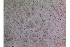 Immunohistochemistry (IHC) analysis of paraffin-embedded Mouse Brain, antibody was diluted at 1:100. (CCL26 anticorps  (Internal Region))