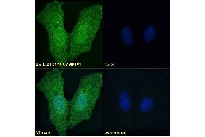 ABIN184943 Immunofluorescence analysis of paraformaldehyde fixed U2OS cells, permeabilized with 0. (TRAK2 anticorps  (C-Term))