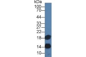 Detection of SAA in Human Serum using Monoclonal Antibody to Serum Amyloid A (SAA) (SAA anticorps  (AA 19-122))