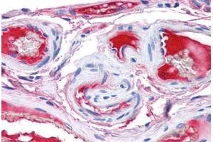 Human Small Intestine, Vessels (formalin-fixed, paraffin-embedded) stained with F12 antibody ABIN337368 at 5 ug/ml followed by biotinylated anti-goat IgG secondary antibody ABIN481715, alkaline phosphatase-streptavidin and chromogen. (F12 anticorps)