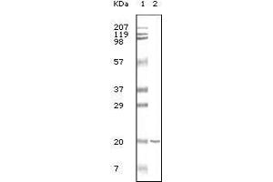 Western Blot showing CD19 antibody used against CD19 recombinant protein.